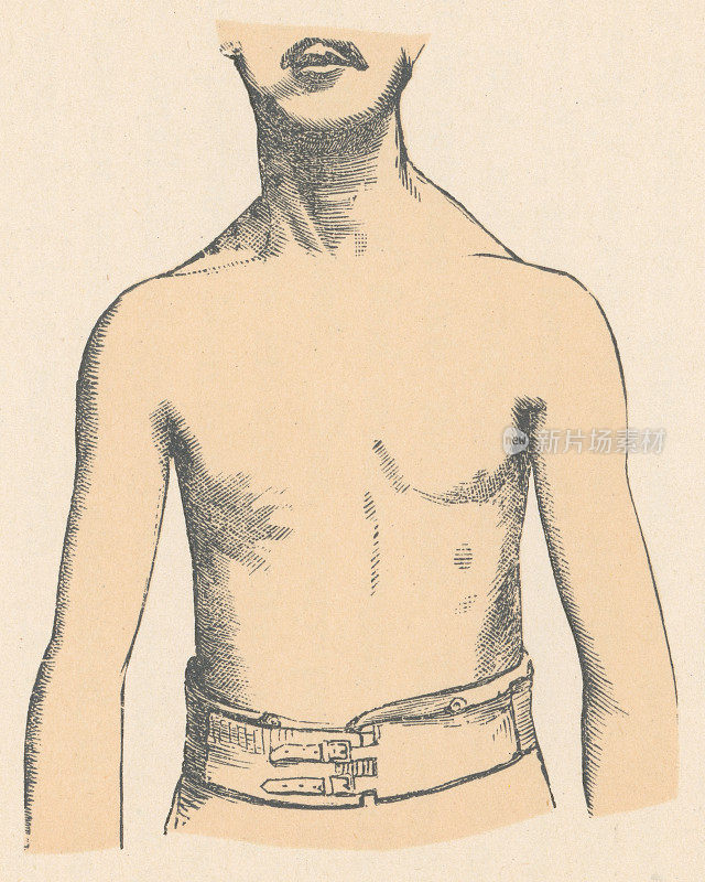 人体躯干薄的医学插图- 19世纪